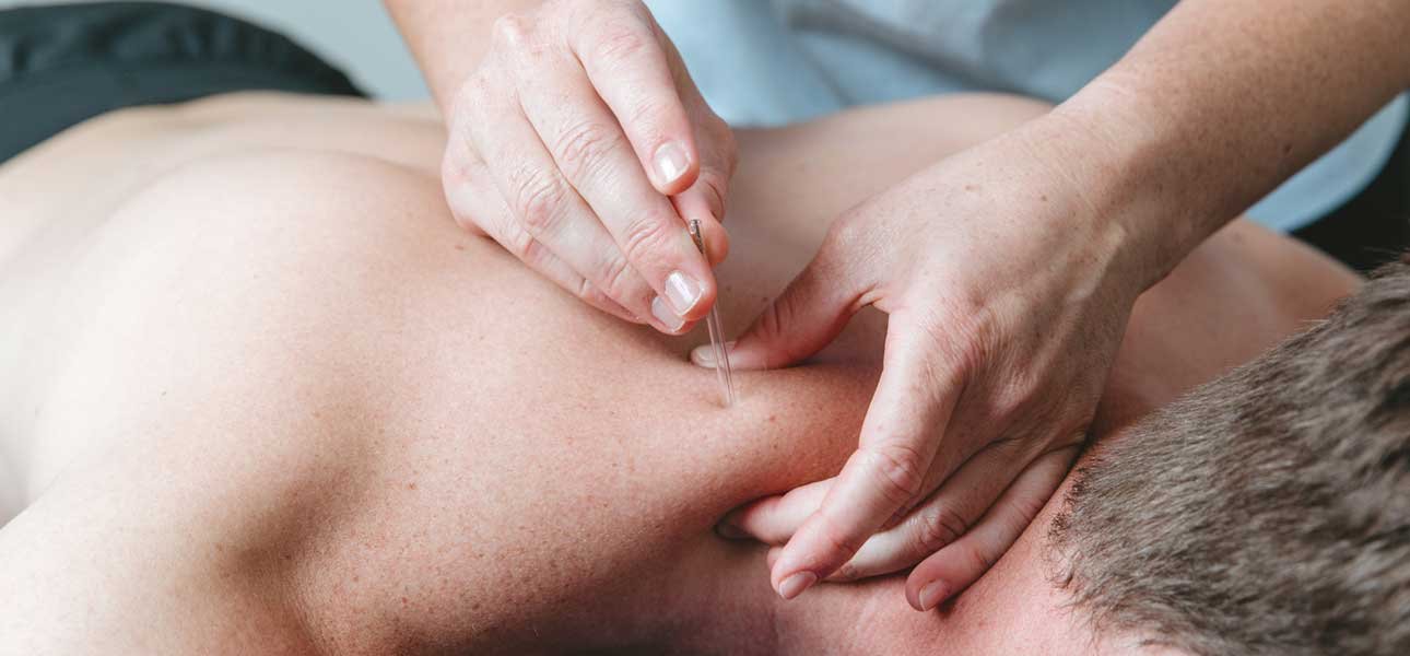 Dry Needling Therapy Treatment